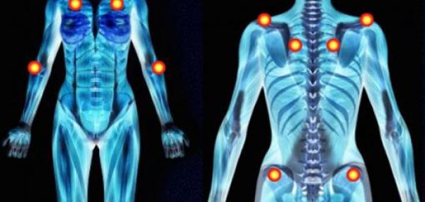 Fibromyalgie: Wie damit leben?